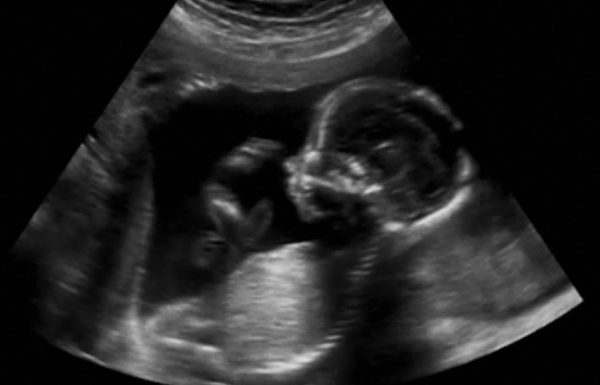 2D_ultrasound bathmate blog