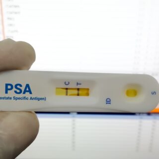 Rapid diagnostic test for PSA or Prostate Specific Antigen