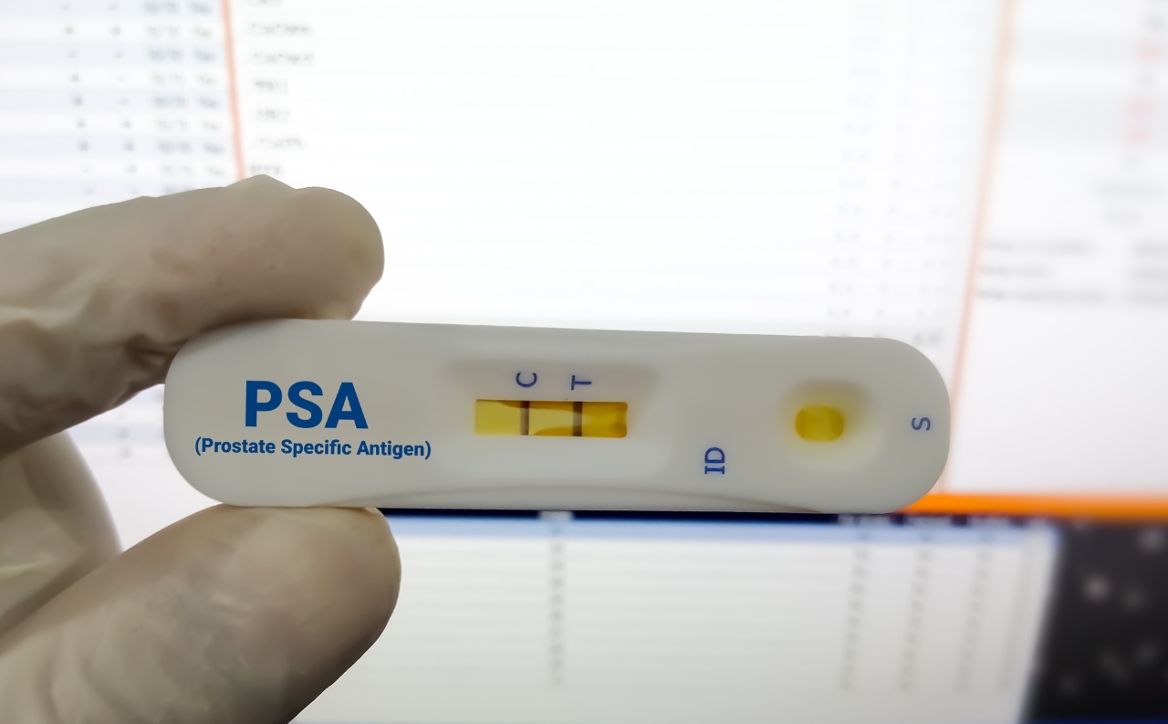 Rapid diagnostic test for PSA or Prostate Specific Antigen