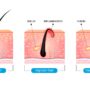 infographics of hair and skin
